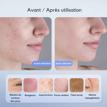 Masque LED Visage Anti-Âge Professionnel